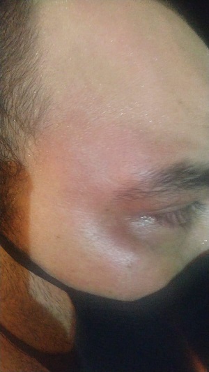 Produtor musical denuncia dono de churrascaria por agressão física