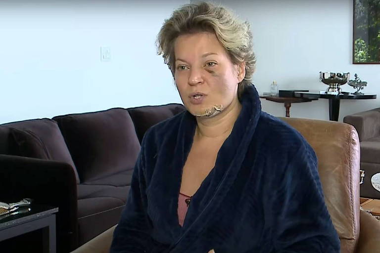 Joice Hasselmann diz que sofreu ataque e mostra lesões