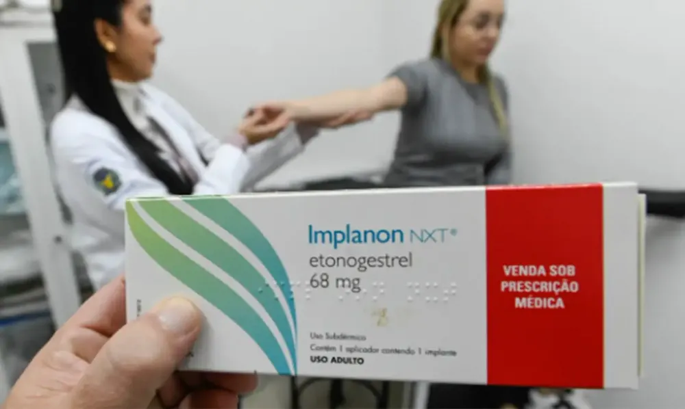 Implante contraceptivo deve ser ofertado por planos de saúde a partir desta segunda (01)